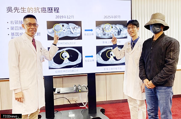 精準醫療 四期肺癌病人存活逾6年